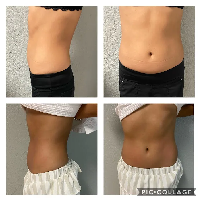 Sense of Skin Picture 9