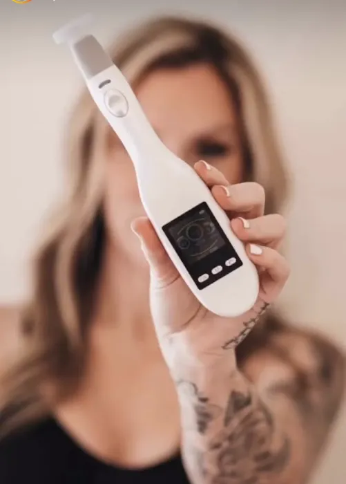 Eternal Youth Plasma Skin Tightening Therapy Picture 3