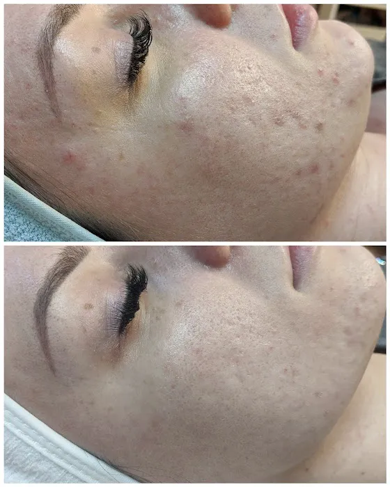 Yesskin Skin Care Picture 7