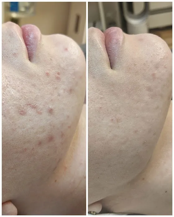 Yesskin Skin Care Picture 8