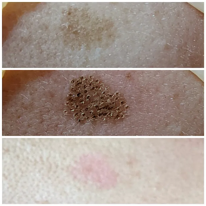 Yesskin Skin Care Picture 10