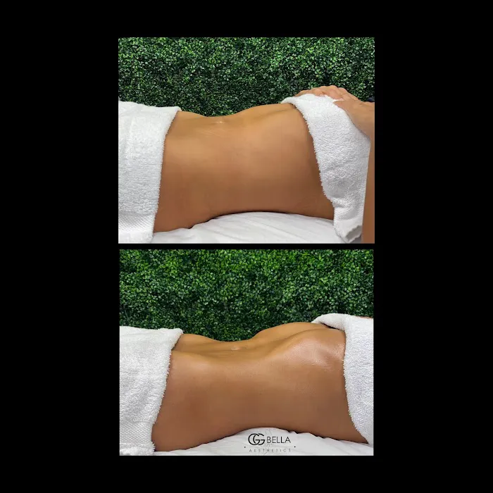 GG Bella Aesthetics Picture 3