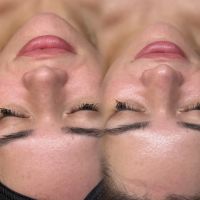 HoneyDee Aesthetics ico