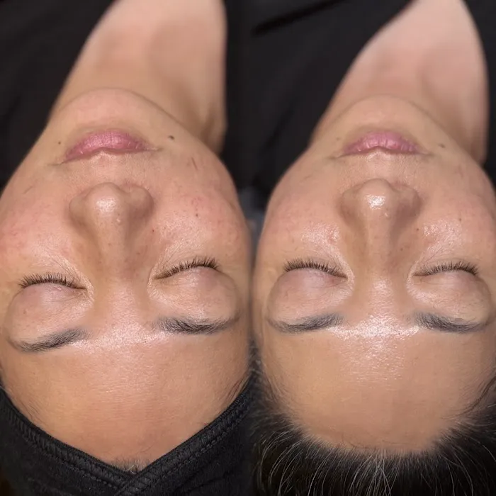 HoneyDee Aesthetics Picture 5