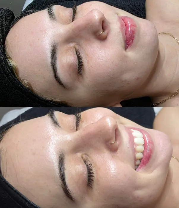 Caleigh Ann Esthetics Picture 3