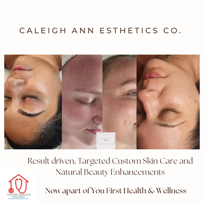 Caleigh Ann Esthetics Picture 6