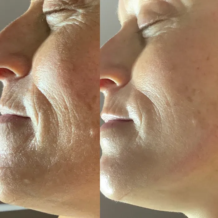 The Florida Esthetician Picture 4