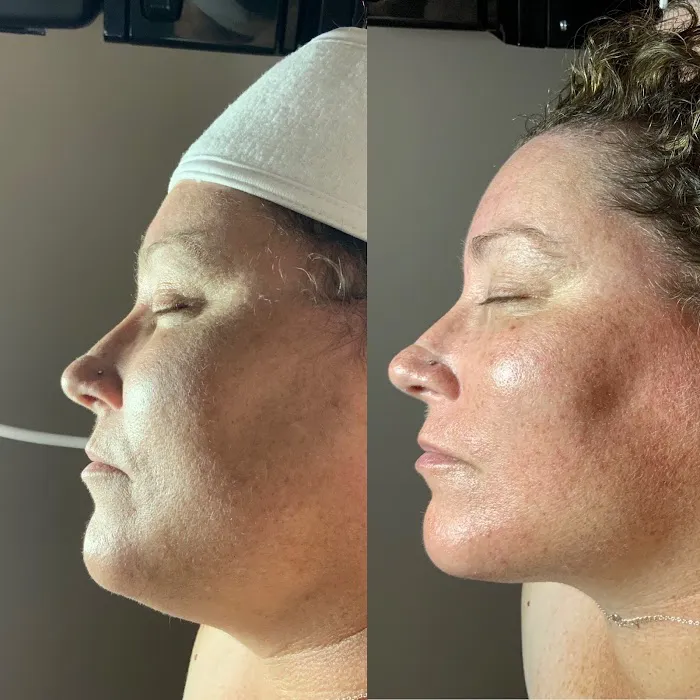 The Florida Esthetician Picture 7