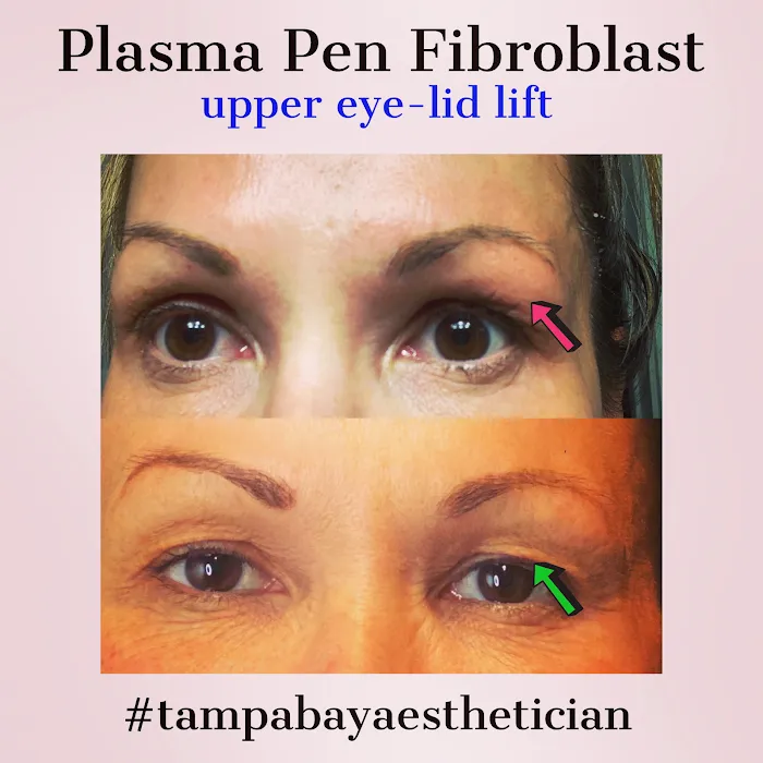 Auracle Aesthetics Picture 1