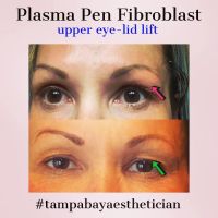 Auracle Aesthetics ico