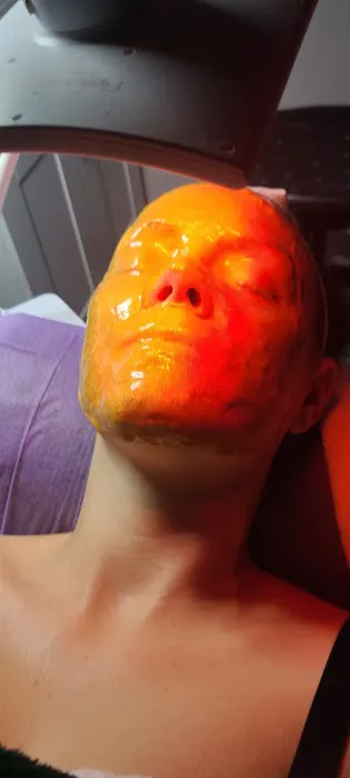 SkinSentives Picture 2