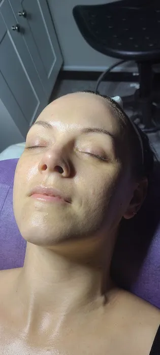 SkinSentives Picture 4