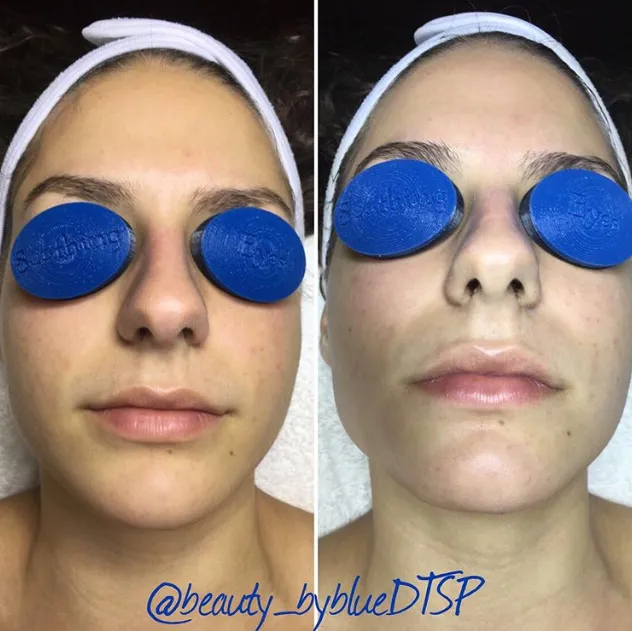 Beauty By Blue Esthetics Picture 2