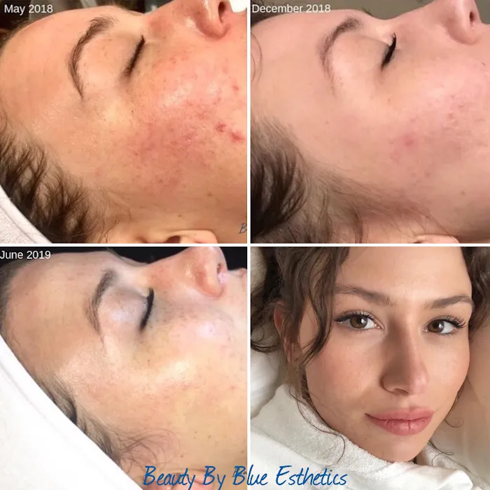 Beauty By Blue Esthetics Picture 3