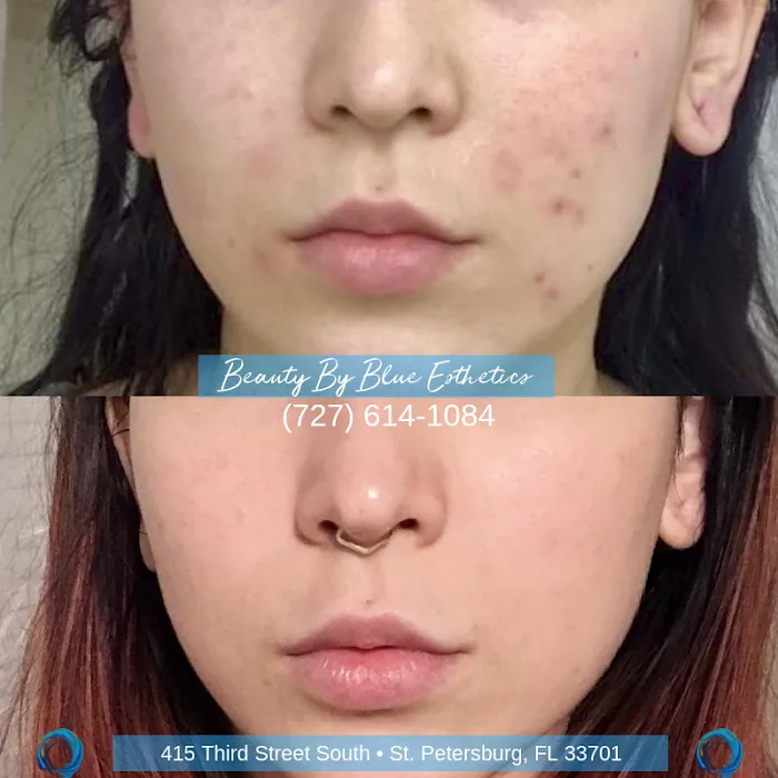 Beauty By Blue Esthetics Picture 5