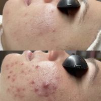 Acne Specialists of Nashville ico
