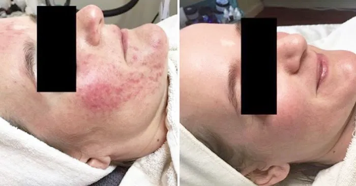 Acne Specialists of Nashville Picture 2