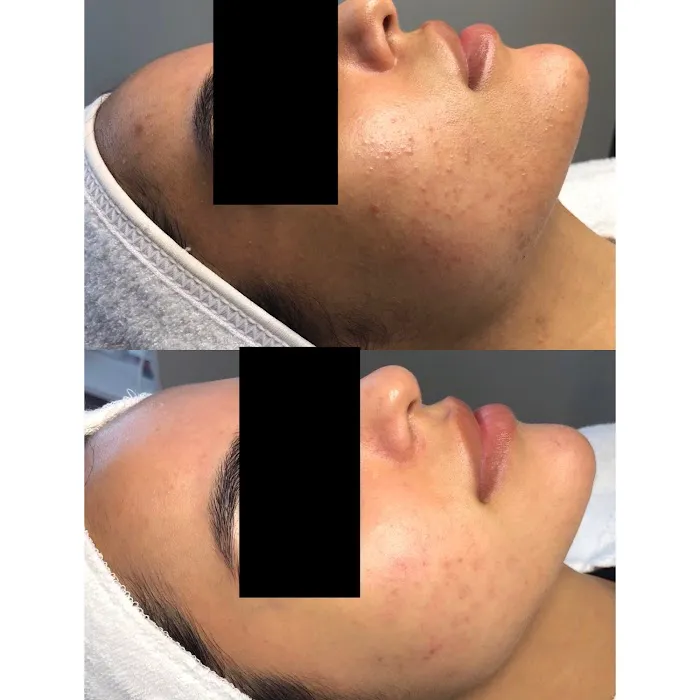 Acne Specialists of Nashville Picture 4