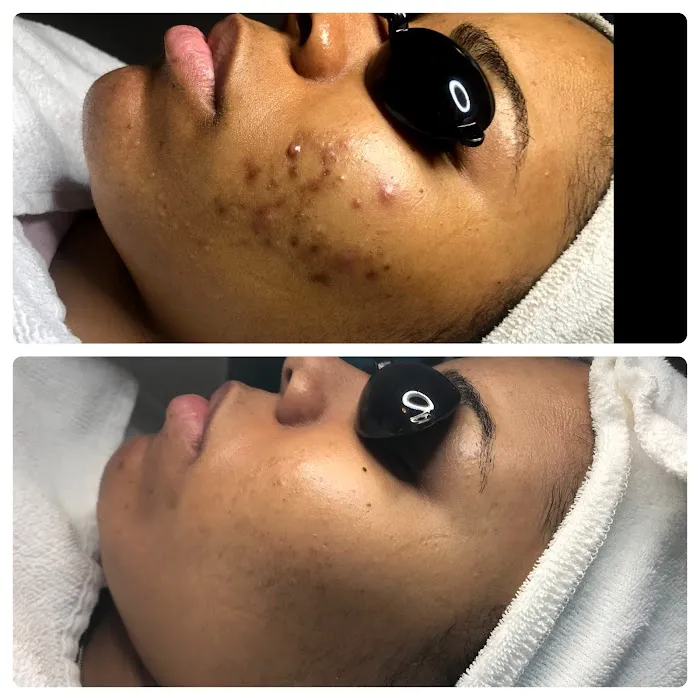Acne Specialists of Nashville Picture 3