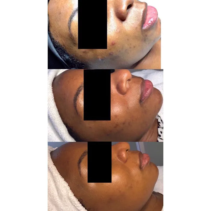 Acne Specialists of Nashville Picture 9