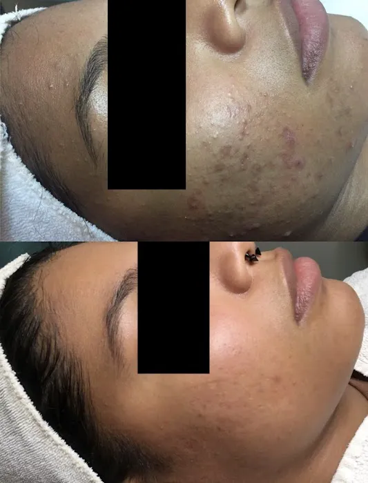 Acne Specialists of Nashville Picture 7
