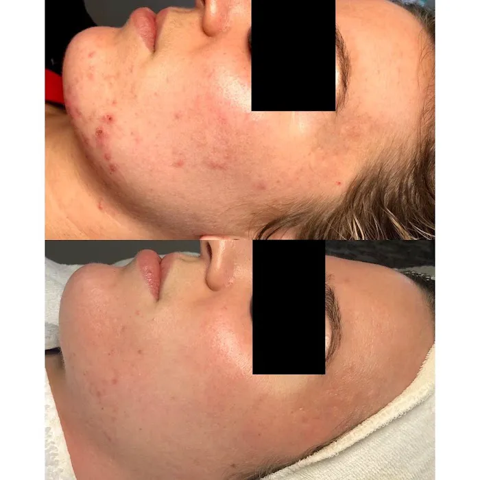 Acne Specialists of Nashville Picture 10