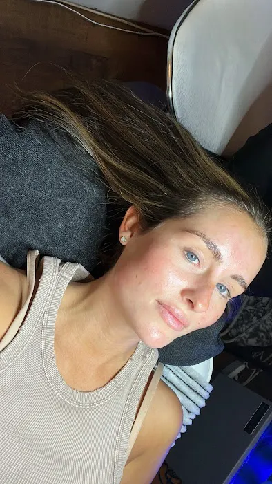 WPS Clinical Skin Picture 3