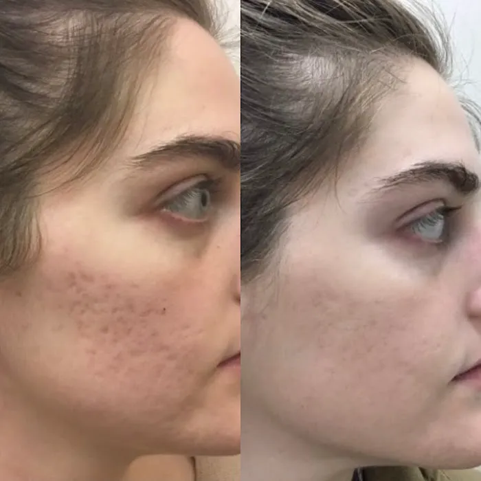 The Skin Angel Aesthetics Picture 9