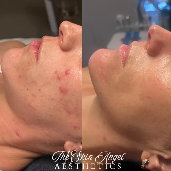 The Skin Angel Aesthetics Picture 10