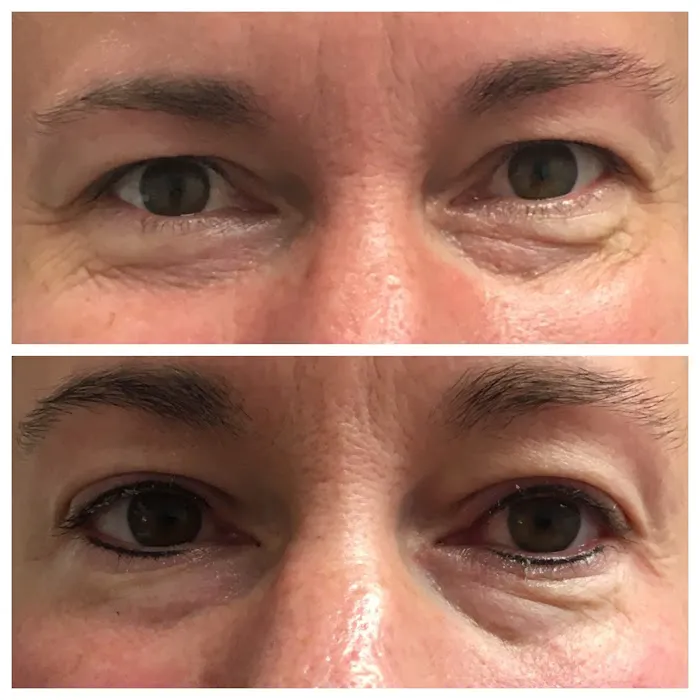 Skin by Jen Picture 8