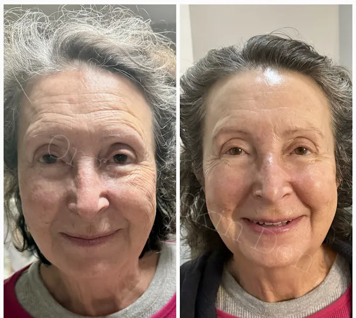 Organic Skin Den Picture 2