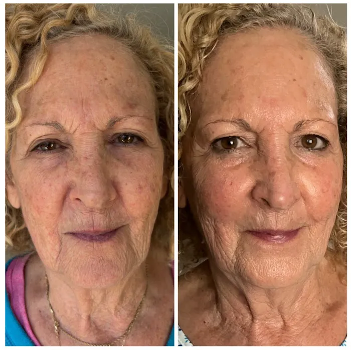 Organic Skin Den Picture 6