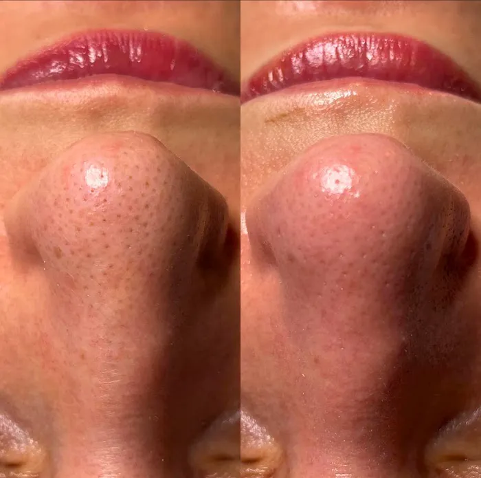 Skin By Jodi Lynn Picture 6