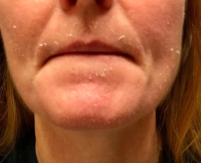 I DO SKIN! Picture 6