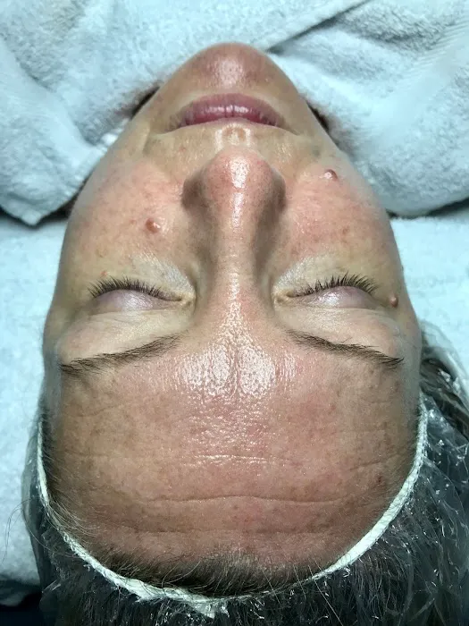 I DO SKIN! Picture 7