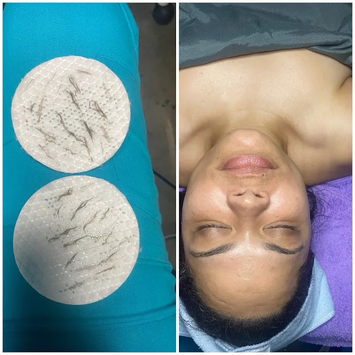 Loveli Aesthetics Picture 7