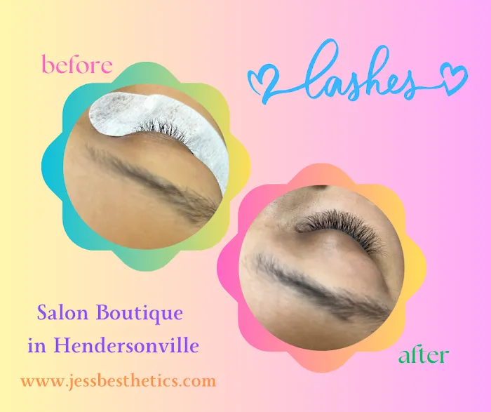 Jess B. Esthetics Picture 7