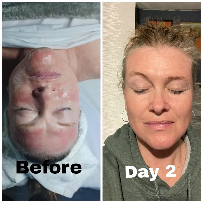 Kb Skincare Picture 3