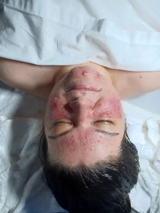 Kb Skincare Picture 9