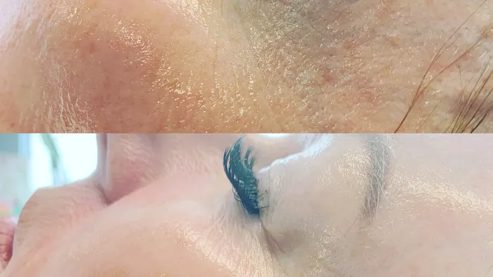 Lesia Hook Skincare Picture 6