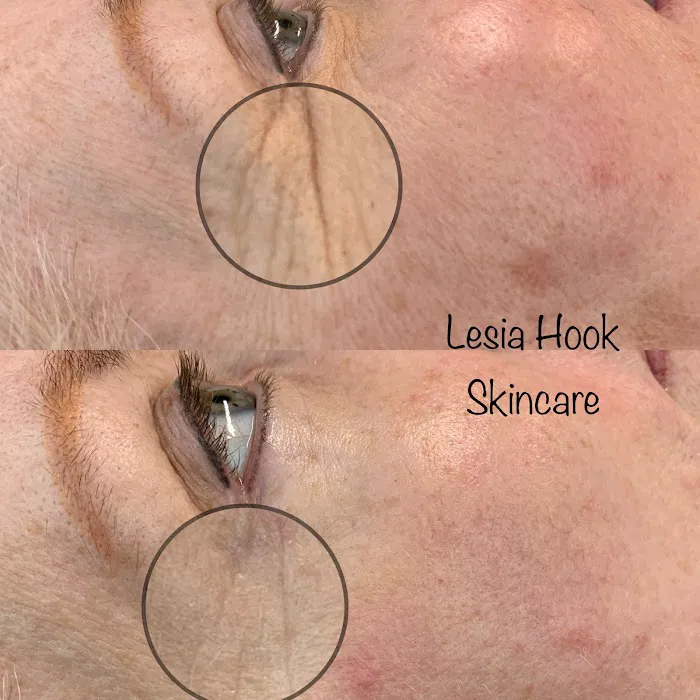 Lesia Hook Skincare Picture 10