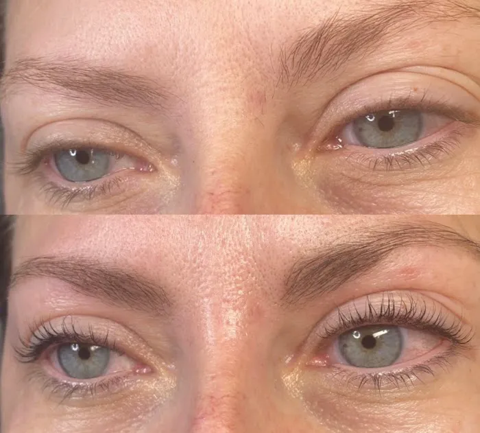 GLOW Esthetics By EmJ. Picture 3