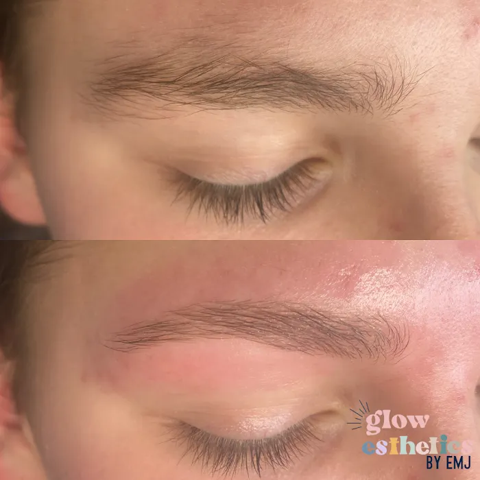 GLOW Esthetics By EmJ. Picture 6