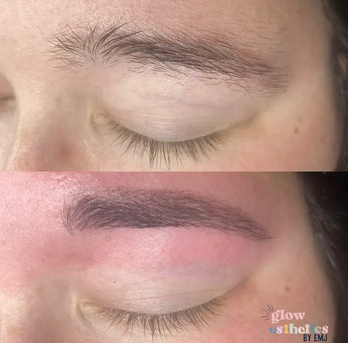 GLOW Esthetics By EmJ. Picture 4