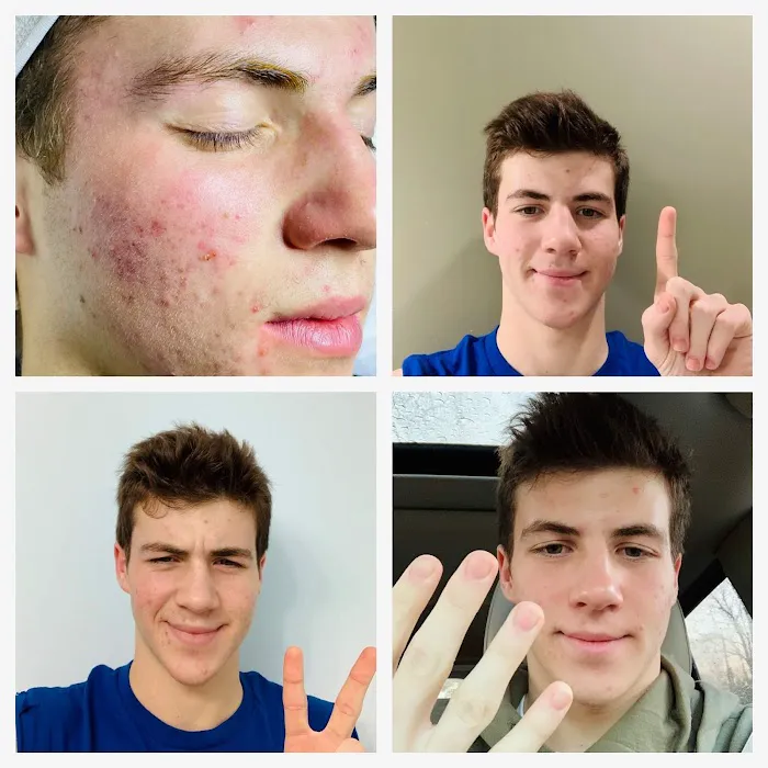 The Acne Clinic co Picture 3