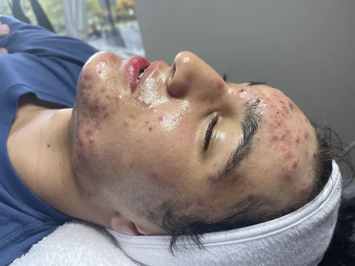 The Acne Clinic co Picture 1