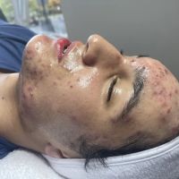 The Acne Clinic co ico