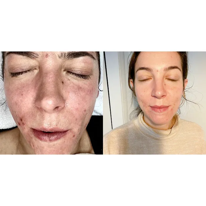 The Acne Clinic co Picture 5