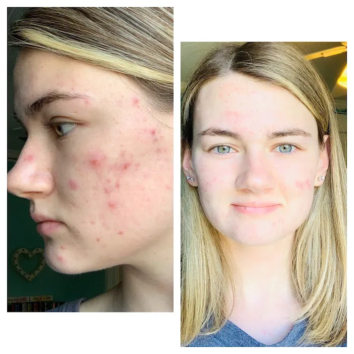 The Acne Clinic co Picture 7