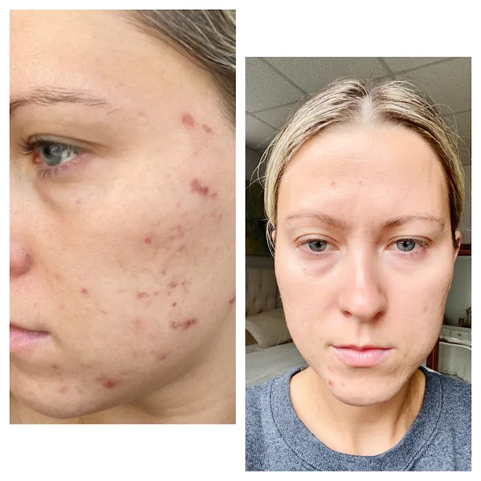 The Acne Clinic co Picture 4